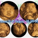 4d dr siti scan