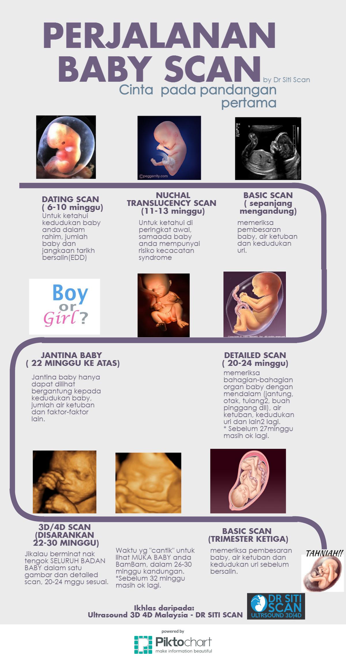 baby-scan